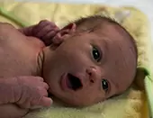 Женщина родила ребенка после трансплантации тканей яичника