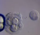 ПГД эмбрионов при ЭКО в Швейцарии
