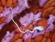 Специалисты тщательно изучили способ передвижения сперматозоидов