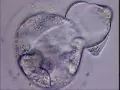 Ученые определили оптимальное количество эмбрионов для переноса в цикле ЭКО