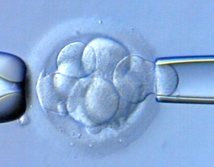 43632 биопсия эмбриона.jpg