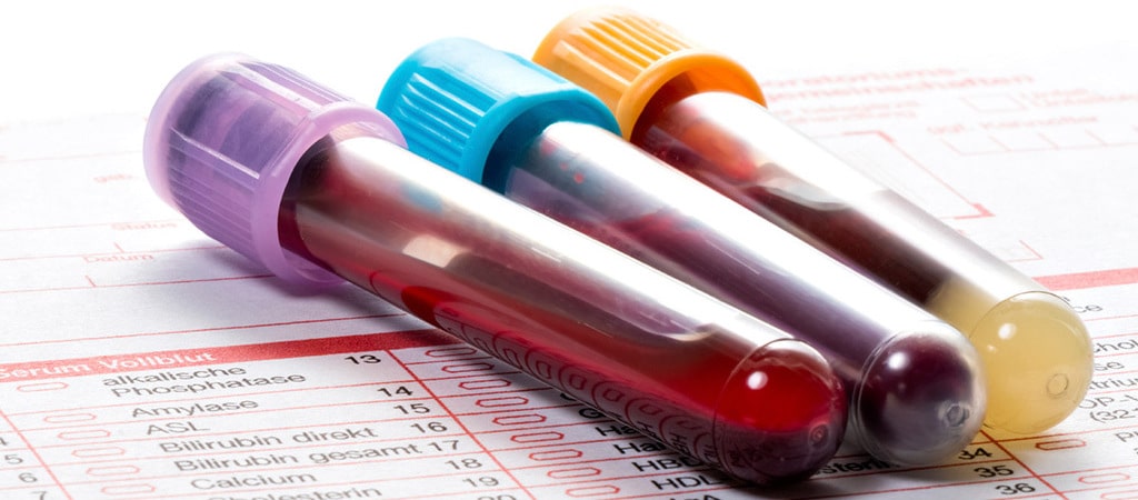 Сдача анализа крови при планировании