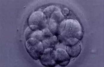 В Нидерландах разрешат выращивать эмбрионы человека с исследовательскими целями