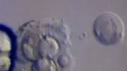 ПГД эмбрионов при ЭКО в Швейцарии