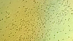 Dr. Ogorodnikov: about factors affecting sperm properties