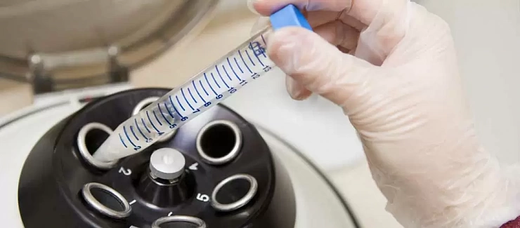 Почему перегревание тестикул приводит к бесплодию — PCR News